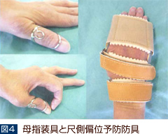 手・足の変形予防法