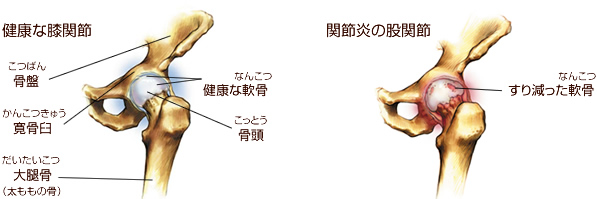 股関節のしくみ